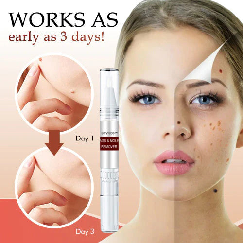 ššBUY 1 GET 1 FREEšLOVILDS⢠Tags & Moles Remover