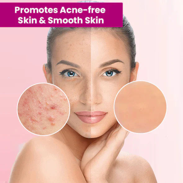 ššBUY 1 GET 1 FREEšLOVILDS⢠Tags & Moles Remover